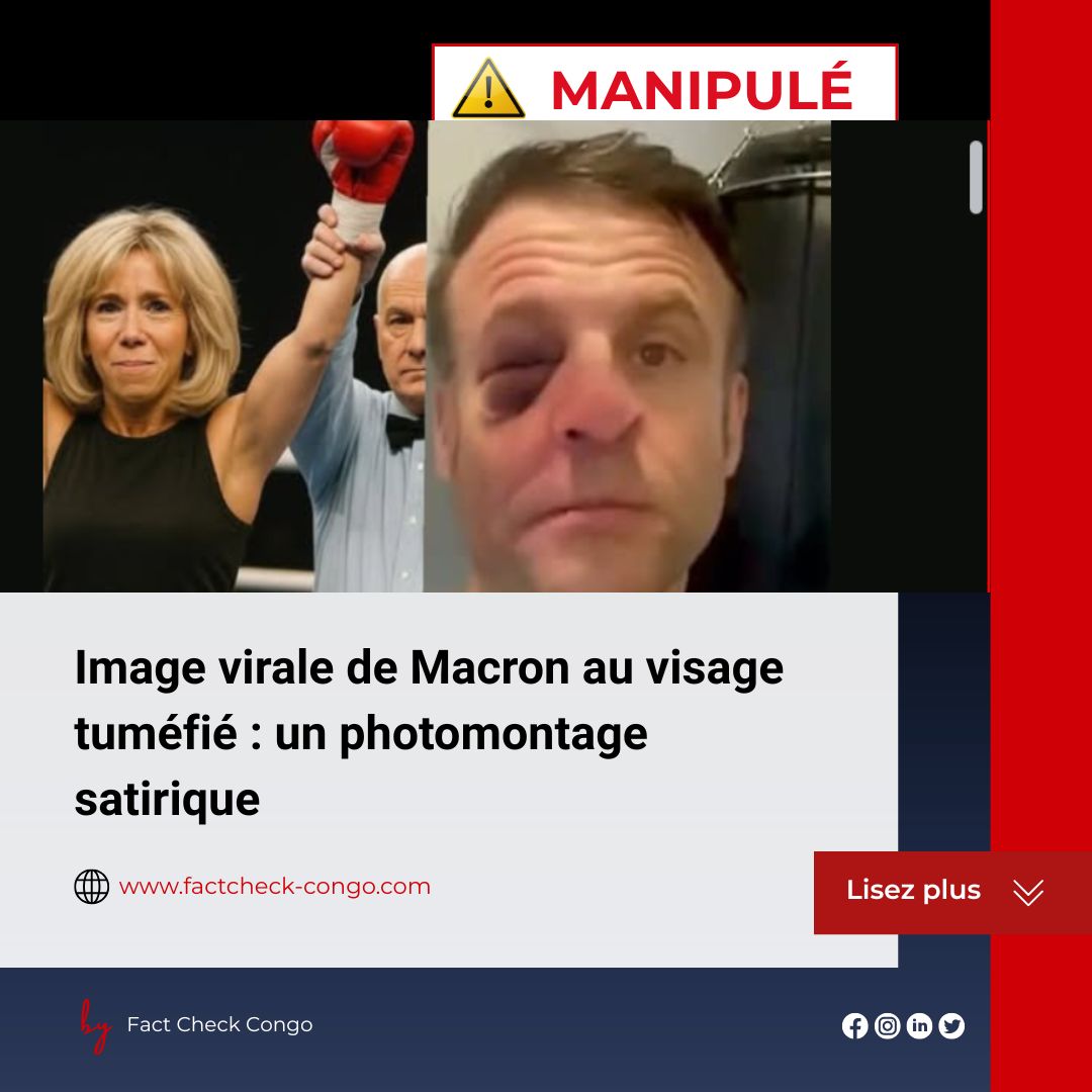 Image virale de Macron au visage tuméfié : un photomontage satirique